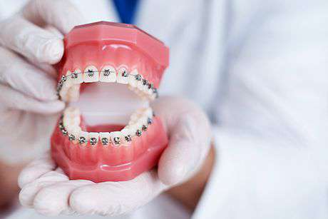 Orthodontics